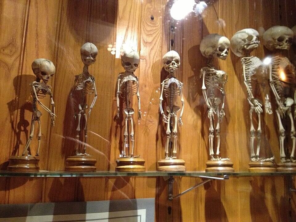The Mรผtter Museum; Pennsylvania, USA